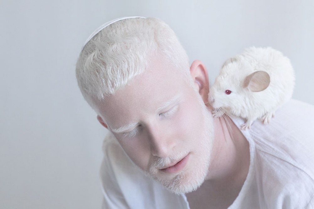 альбинос 5