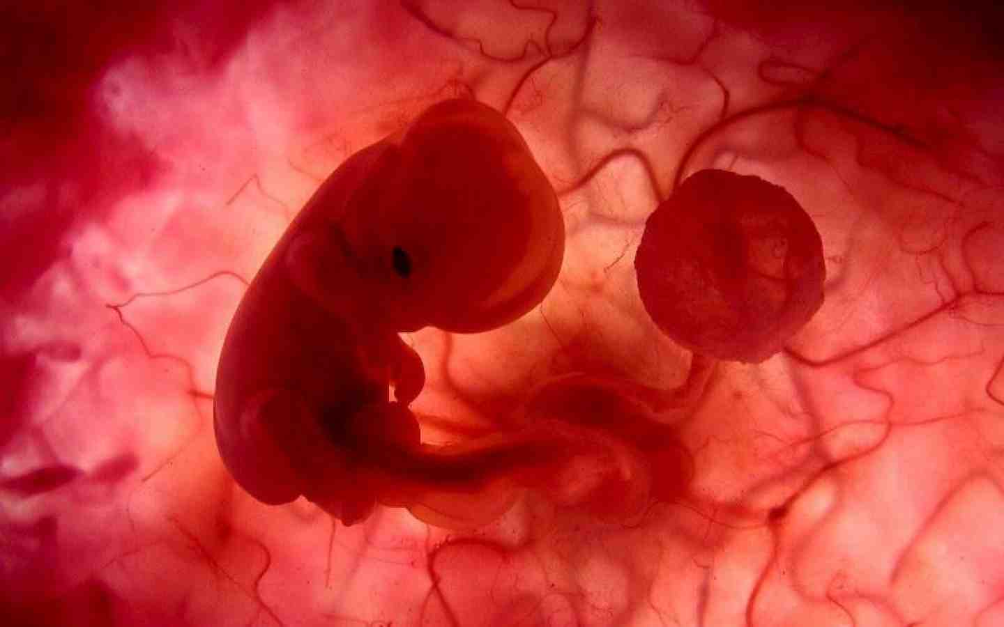 эмбрион 2