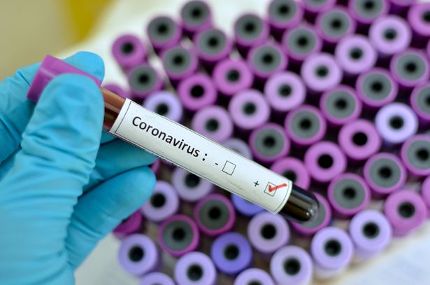 В США от коронавируса могут умереть 2,2 миллиона человек