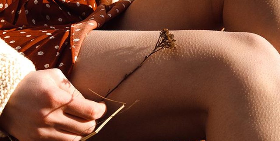 Гусяча шкіра.