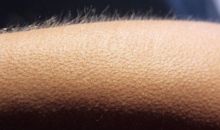 Чому виникають «мурашки по шкірі»: пояснення реакції організму